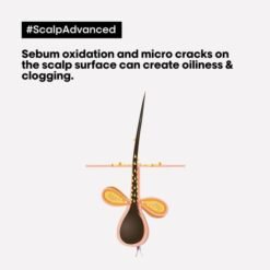 L'Oréal Serie Expert Scalp Advanced Anti-Gras Oiliness Shampoo